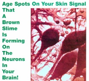 Brown slime forming on your neurons